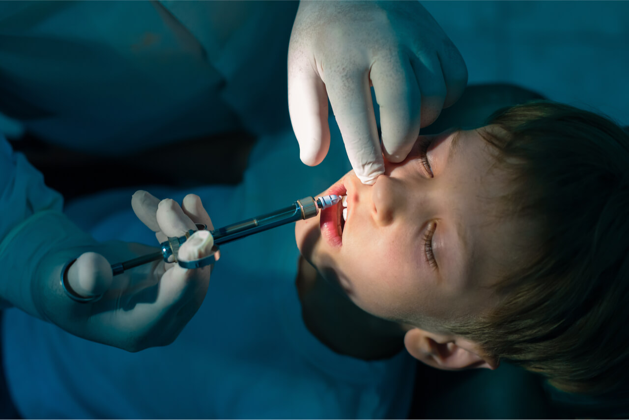 General Anesthesia for Toddler Dental Work IT Pharmacy